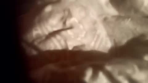 moos1 online show from 28, 2, 2026